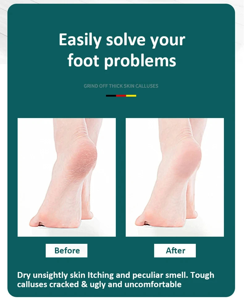 SmoothStep™ Stainless Steel Foot File